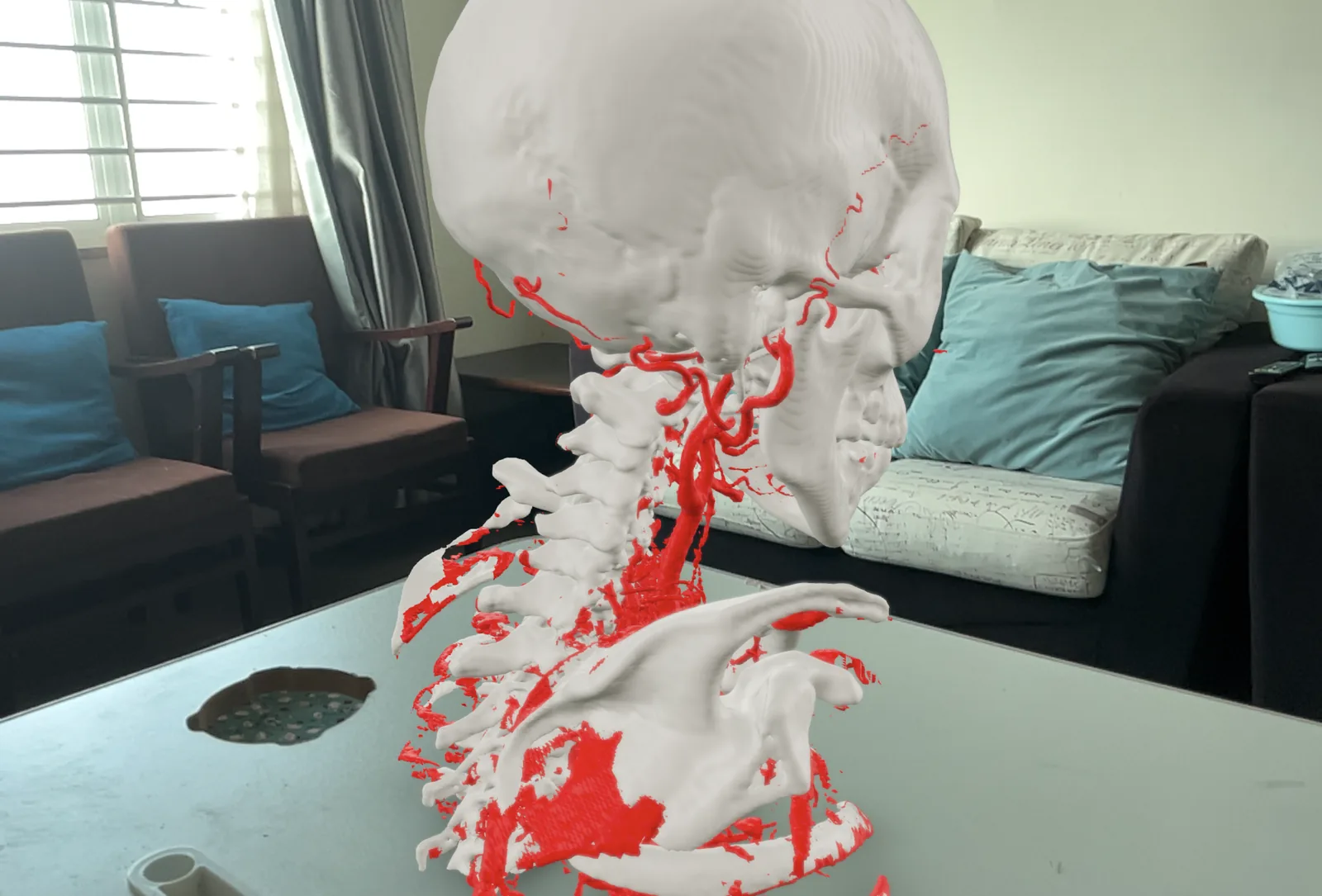 A bone and vessel model standing on a table in AR.