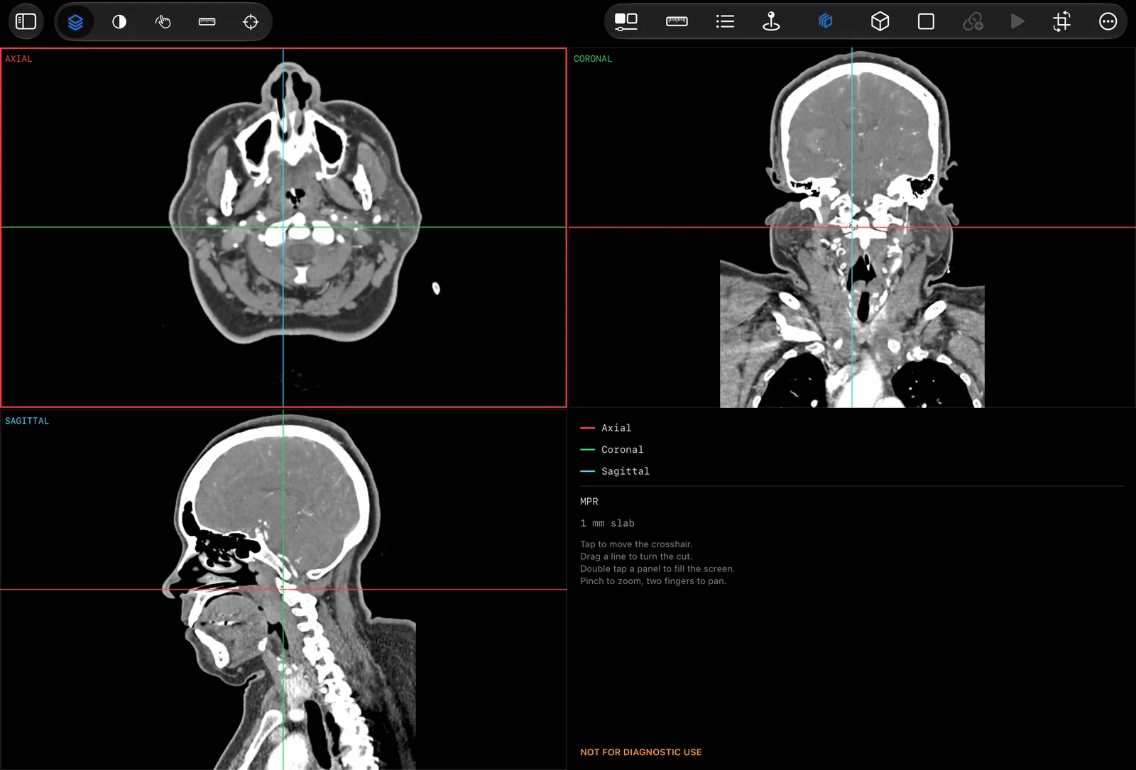 Axial, coronal and sagittal reformats of a head and neck CT in three panels, with a linked crosshair.